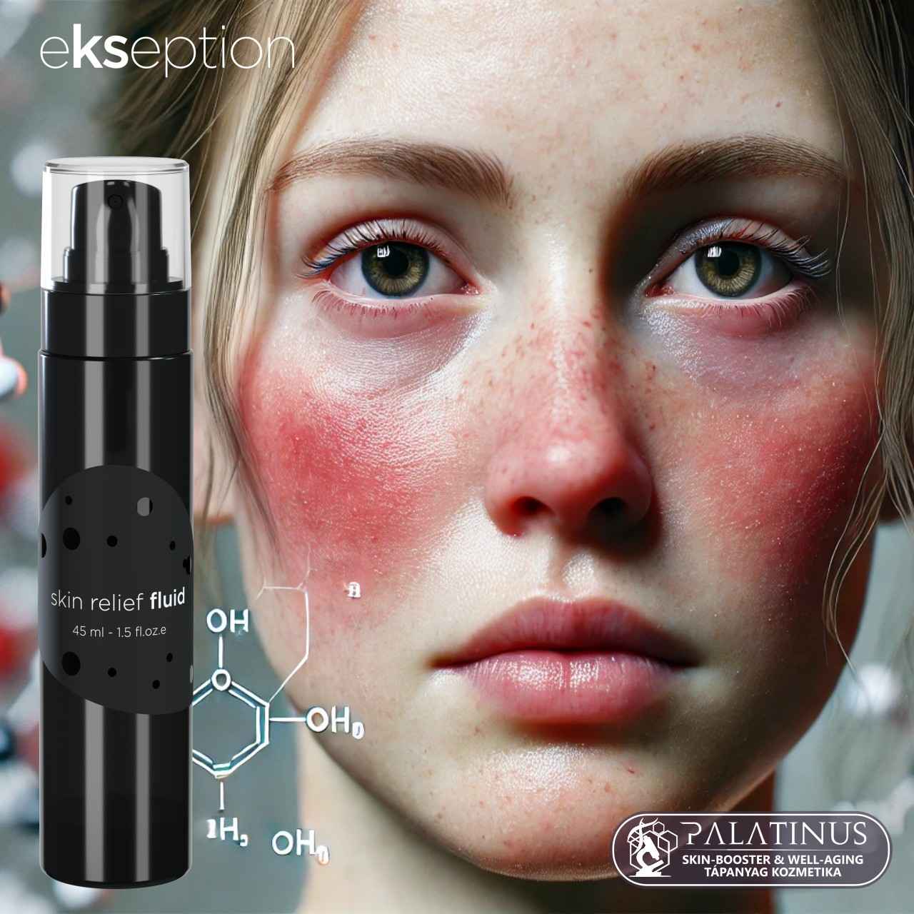 SKIN RELIEF FLUID HMC Flavonoid + Tasmán bors szenzitív bőrgyulladás csökkentő szérum (EKSEPTION) - Image 4