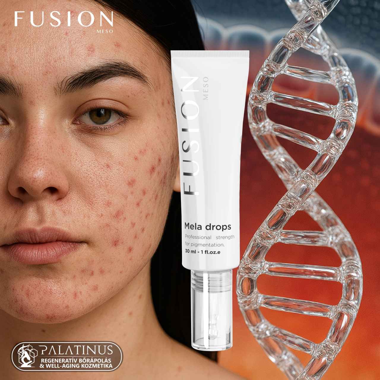 MELA DROPS BOOSTER Pigmentkorrekciós melanin blokkoló szérum (FUSION) - Image 6