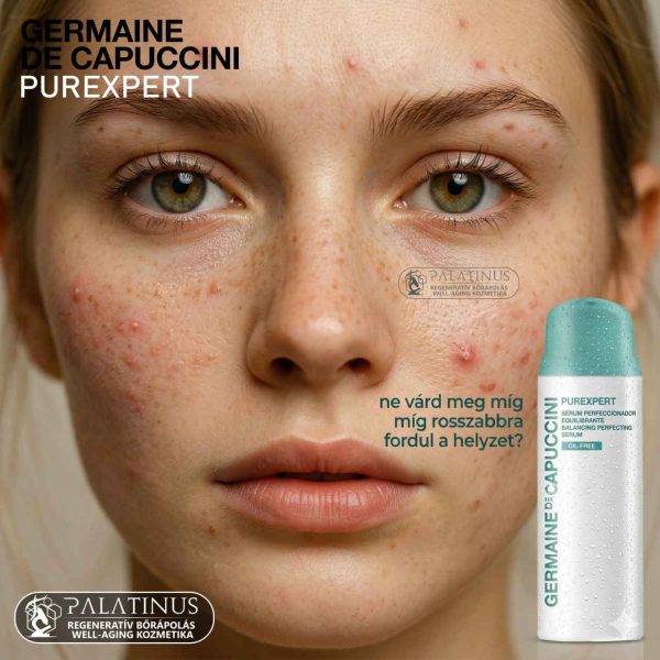 PUREXPERT-Balancing-Perfecting-Serum-Celzott-Faggyuszabalyozo-es-Mikrobiom-Tamogato-Szerum-Germaine-de-Capuccini-Palatinus-Kozmetika-Kecskemet-